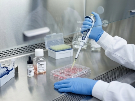 Transfection