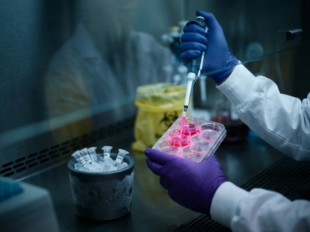 Lentiviral transduction